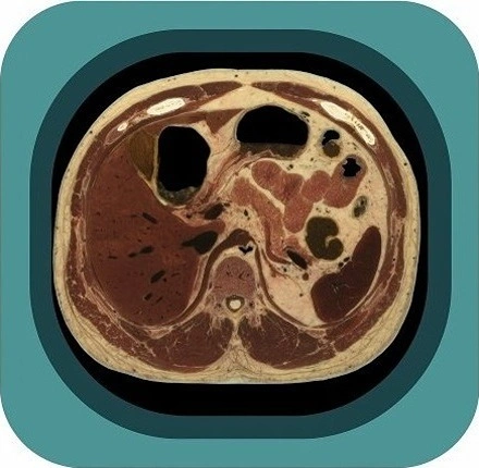 visible body project abdomen anatomy icon-1771230572